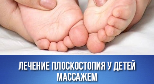 Лечение плоскостопия у детей массажем